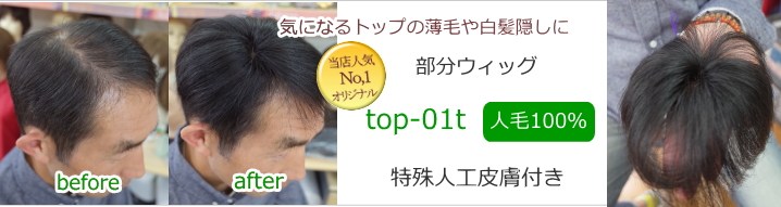 人毛部分ウィッグSサイズtop-01t特殊人工皮膚付き