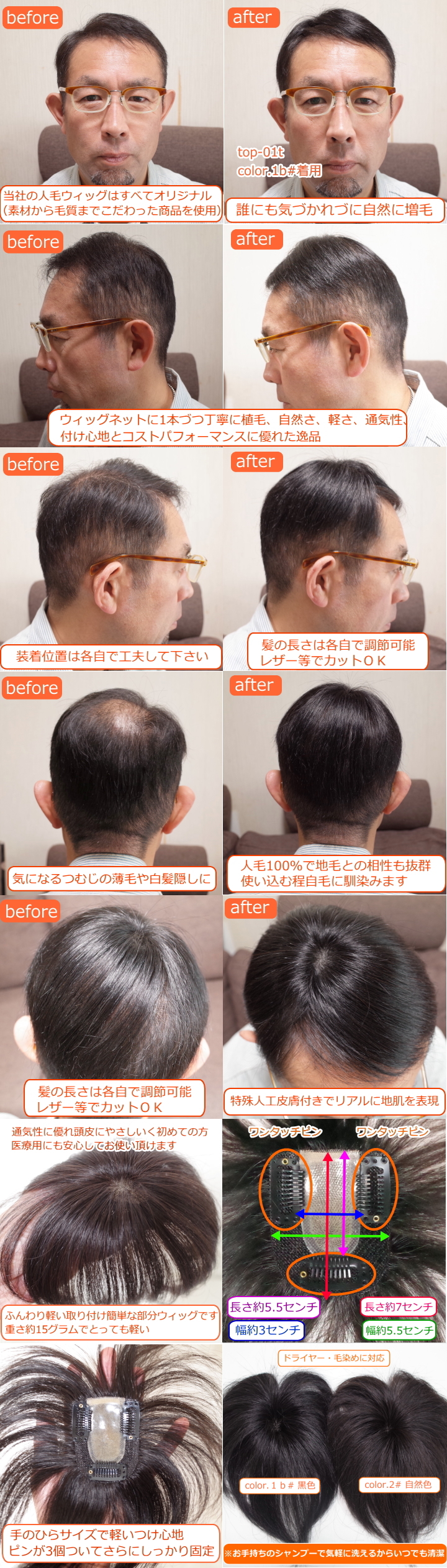 男性用メンズ部分ウィッグSサイズtop-01t取り付け前取り付け後画像＆商品詳細カラー各種画像