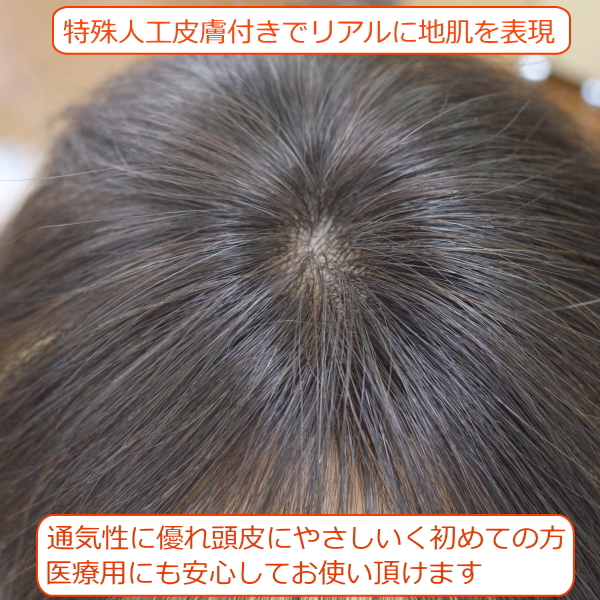 人毛部分ウィッグ Sサイズ 特殊人工皮膚付き 男女兼用 医療用にも最適