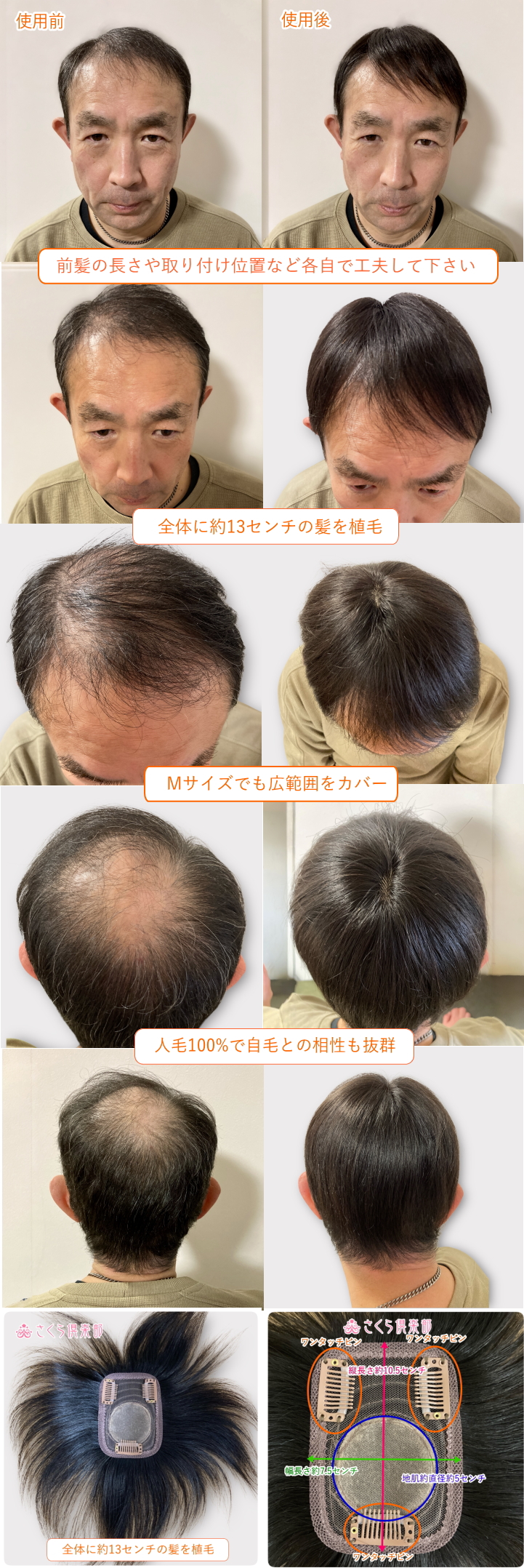 男性用メンズ部分ウィッグtop-03n取り付け前取り付け後画像