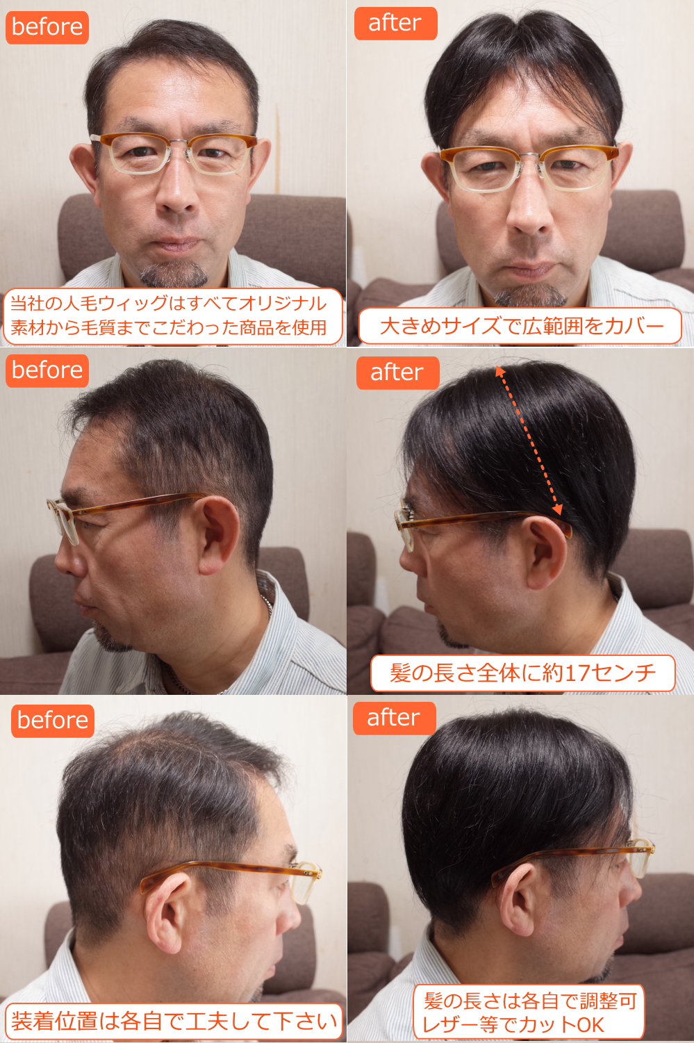 男性用メンズ部分ウィッグLサイズtop-07取り付け前取り付け後画像1