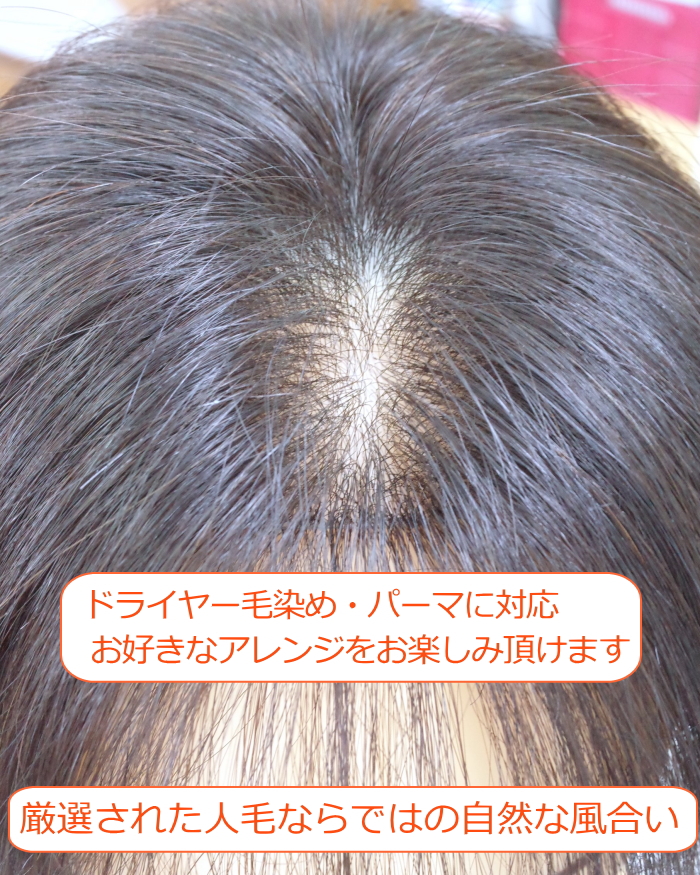 女性用人毛部分ウィッグLサイズセンター分け地肌付きtop-600フロント画像